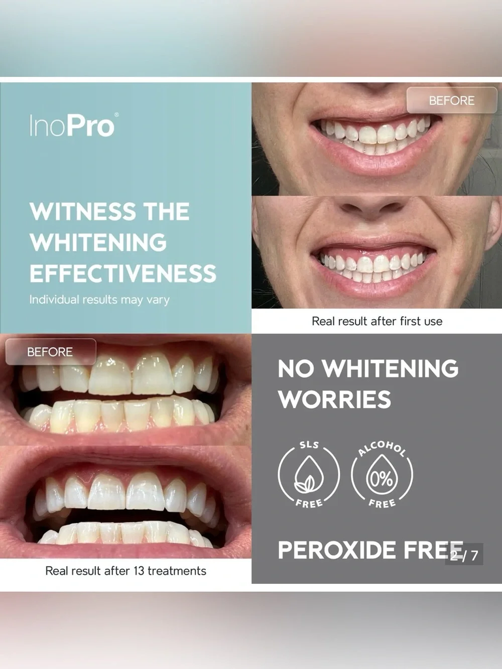 INOPRO BUNDLE | Advanced Teeth Whitening Bromelain Enzyme Based Formula 2 NWT